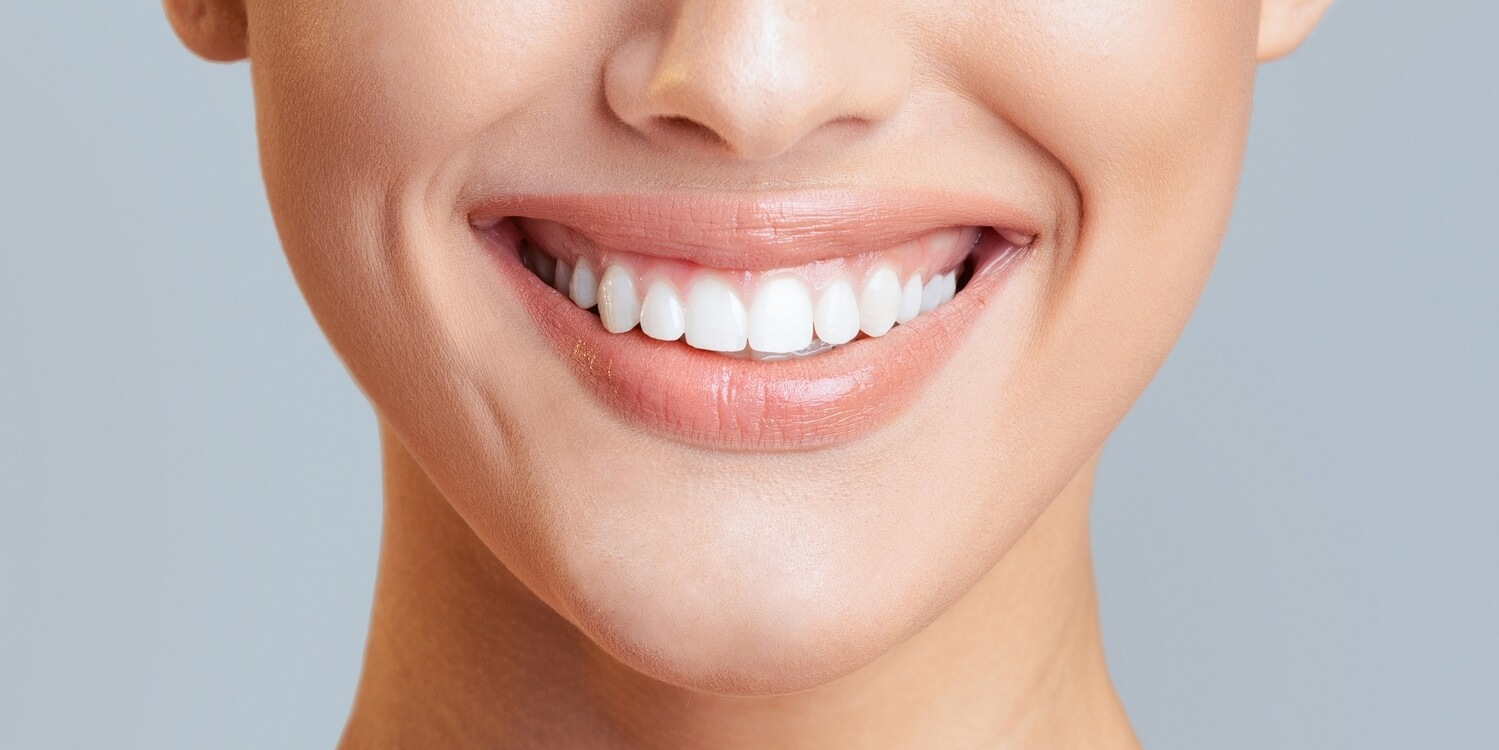 dentisterie esthetique Woluwe