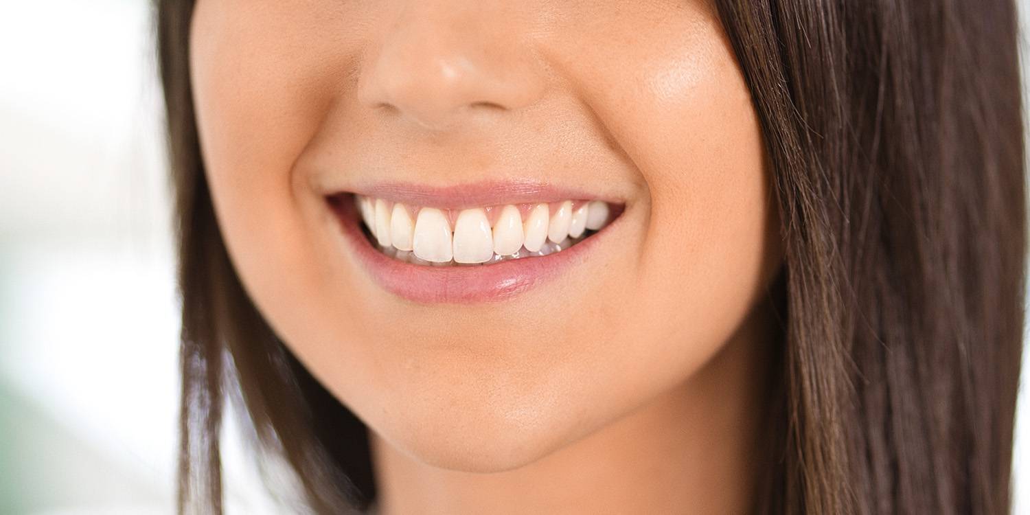 dentisterie esthétique 1500px -comrpessed