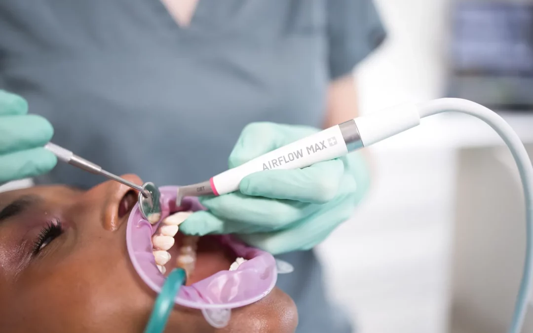 Scaling or GBT hygiene: what is the difference for your teeth?